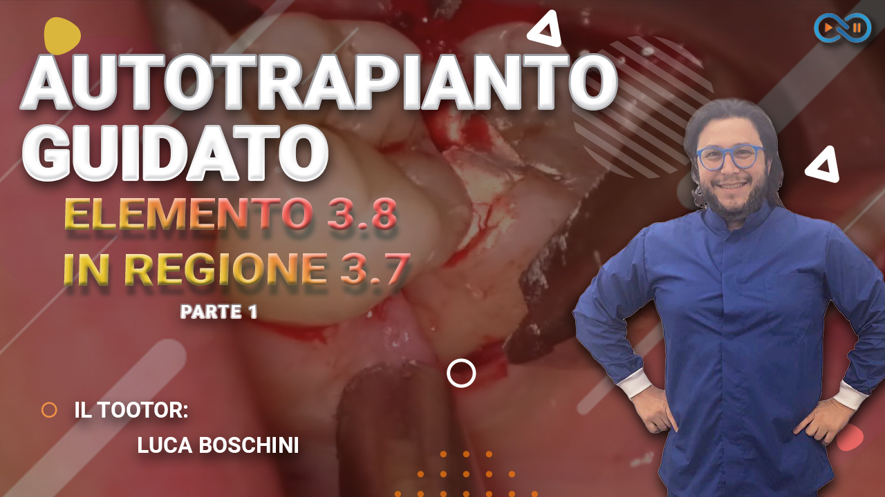 Autotrapianto_dentale_Boschini