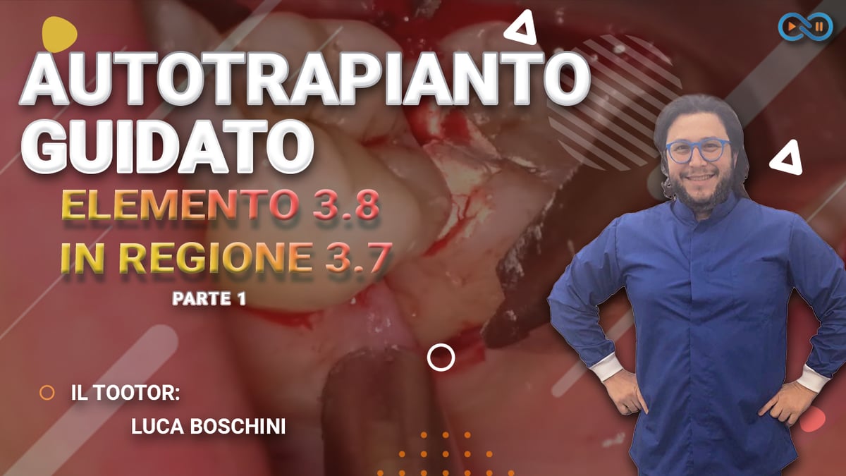 Autotrapianto_dentale_Boschini