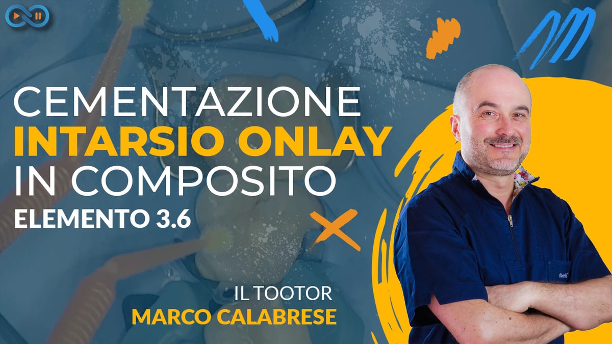 cementazione_intarsio_onlay_composito