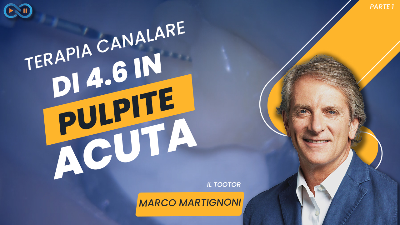 Terapia_canalare_video_Martignoni