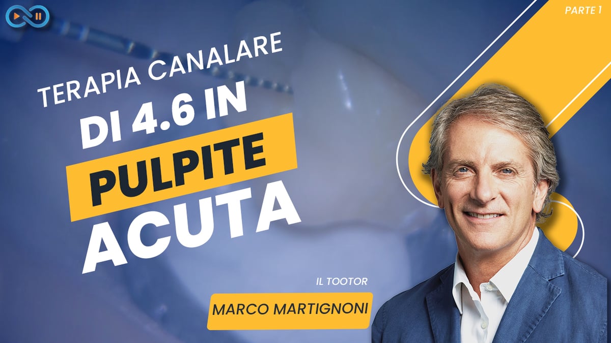 Terapia_canalare_video_Martignoni