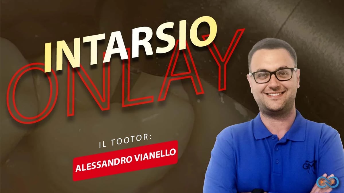 Intarsio_onlay_video_Vianello