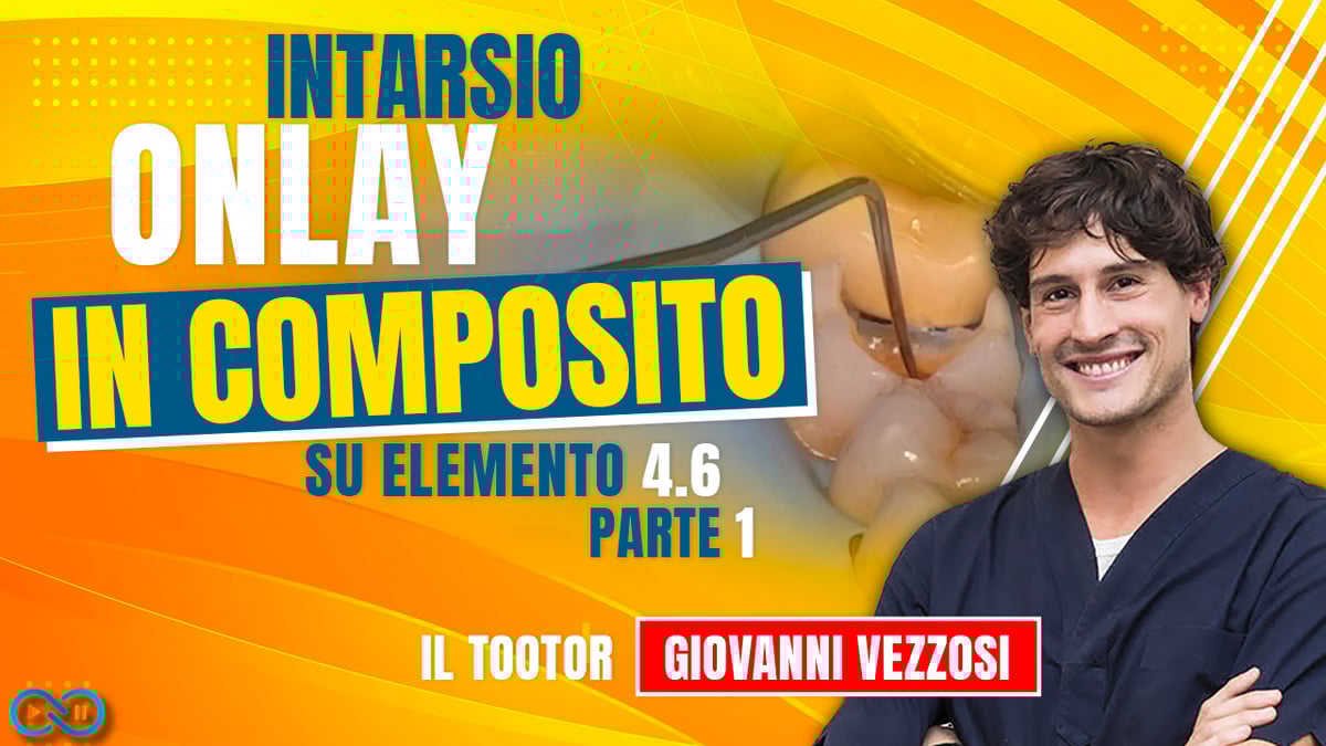 intarsio_onlay_composito